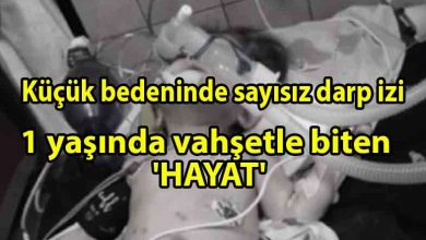 ozgur_gazete_kibris_1-yaşındaki_'hayat'_bebek_hayatını_kaybetti