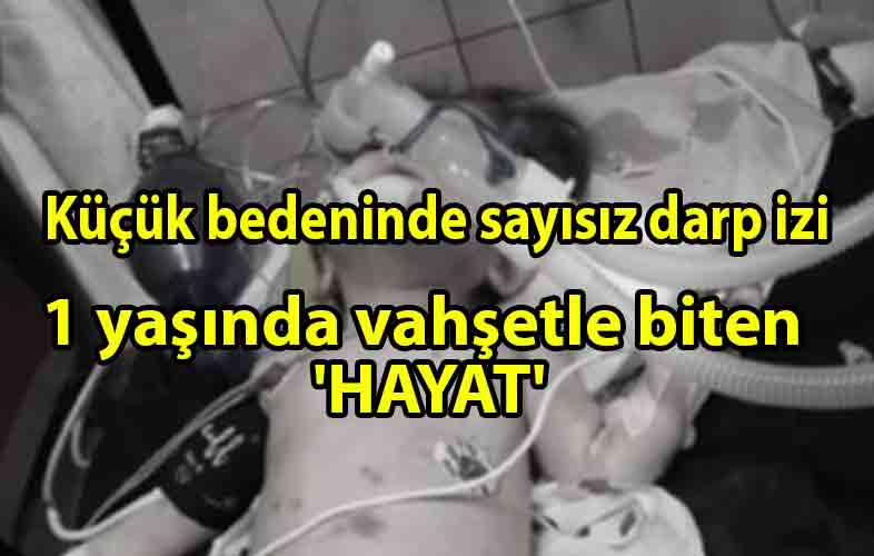 ozgur_gazete_kibris_1-yaşındaki_'hayat'_bebek_hayatını_kaybetti