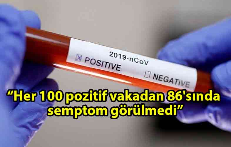 ozgur_gazete_kibris_Bilimsel_araştırma_Her_100_vakadan_86'sında_semptom_görülmedi
