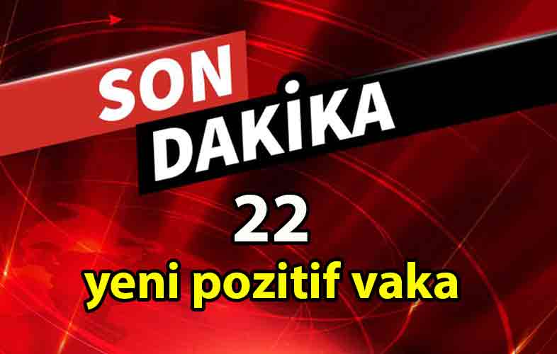 ozgur_gazete_kibris_Güneyde_bugun_toplam_3_bin_477_test_yapıldı