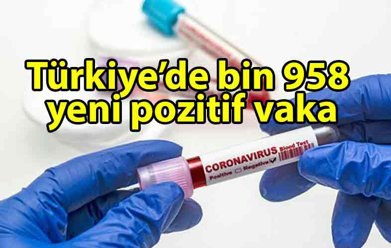 ozgur_gazete_kibris_Türkiye'de_son_24_saatte_bin_958_kişiye_Covid_19_tanısı_konuldu