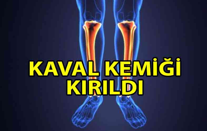 ozgur_gazete_kibris_caglayanda_is_kazasi