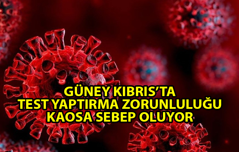 ozgur_gazete_kibris_guney_kibris_test_kaos_yaratiyor