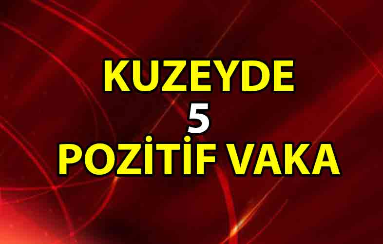 ozgur_gazete_kibris_kuzeyde_5_pozitif_vaka