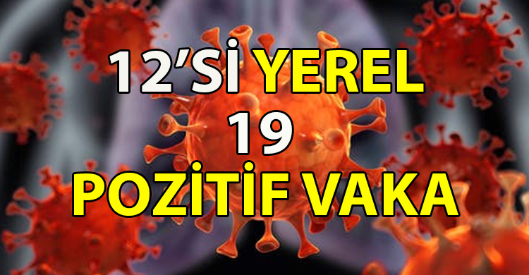 ozgur_gazete_kibris_Toplam_1322_test_yapildi_