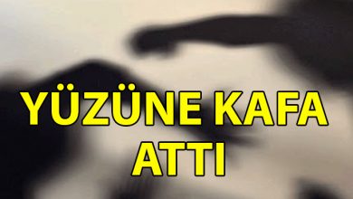 ozgur_gazete_kibris_Yuzune_kafa_atip_burnunu_kirdi