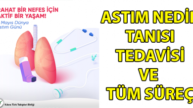 ozgur_gazete_kibris_astim_nedir
