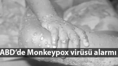 ozgur_gazete_kibris_monkeypox_salgın