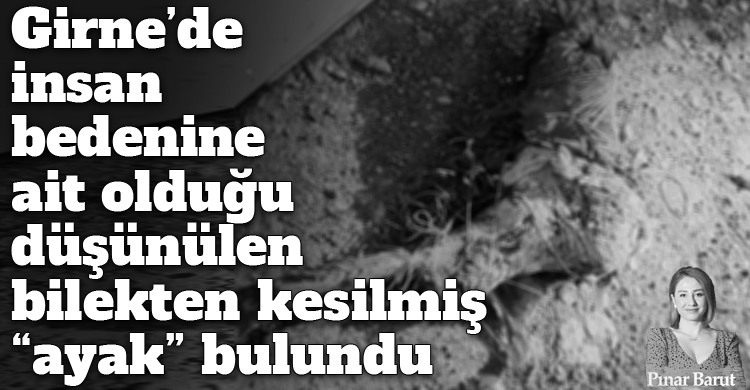 ozgur_gazete_kibris_girne_de_kesilmis_insan_bedeni_ayak